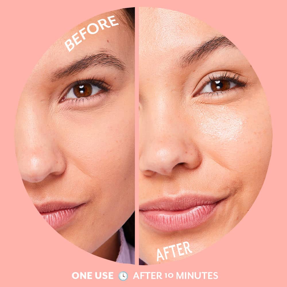 Patchology Bubbly Hydrogel Mask - Single